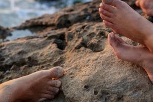 Caring For Your Sunburnt Feet