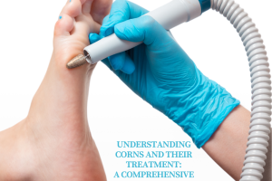 Understanding Corns and Their Treatment A Comprehensive Guide