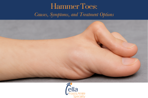 Hammer Toes Causes, Symptoms, and Treatment Options
