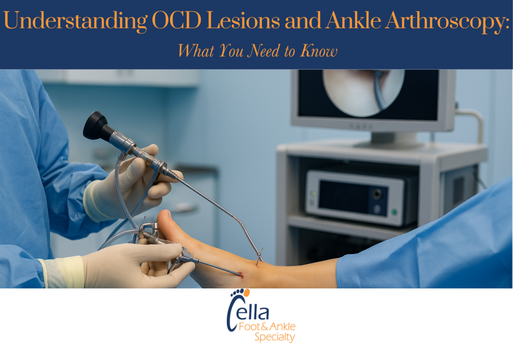 Understanding OCD Lesions and Ankle Arthroscopy What You Need to Know